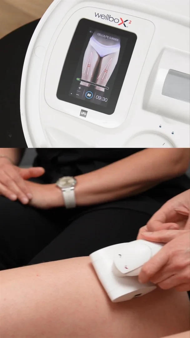 Wellbox : 72 ventes en un live, le pari gagnant du live shopping beauté-tech 8