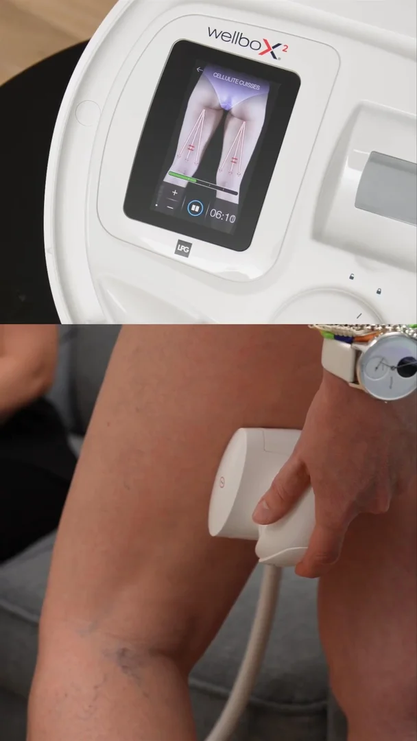 Wellbox : 72 ventes en un live, le pari gagnant du live shopping beauté-tech 10